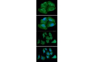 ICC/IF analysis of TXNRD1 in Hep3B cells line, stained with DAPI (Blue) for nucleus staining and monoclonal anti-human TXNRD1 antibody (1:100) with goat anti-mouse IgG-Alexa fluor 488 conjugate (Green). (TXNRD1 抗体)