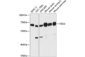 Western blot analysis of extracts of various cell lines using VSIG1 Polyclonal Antibody at dilution of 1:3000. (VSIG1 抗体)