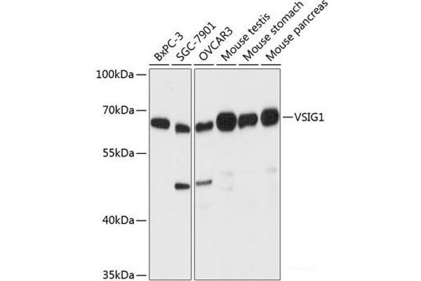 VSIG1 抗体