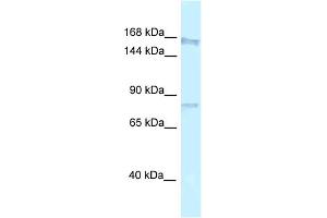 WB Suggested Anti-Arhgap5 Antibody   Titration: 1. (ARHGAP5 抗体  (N-Term))