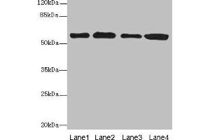 Western blot All lanes: TXNRD1 antibody at 5 μg/mL Lane 1: Jurkat whole cell lysate Lane 2: A549 whole cell lysate Lane 3: MCF-7 whole cell lysate Lane 4: Hela whole cell lysate Secondary Goat polyclonal to rabbit IgG at 1/10000 dilution Predicted band size: 71, 60, 66, 61, 55, 68, 51 kDa Observed band size: 60 kDa (TXNRD1 抗体  (AA 1-497))