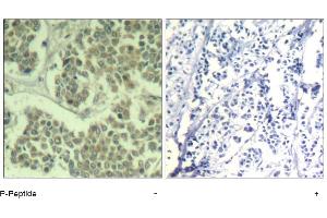 Image no. 1 for anti-Eukaryotic Translation Initiation Factor 2 Subunit 1 (EIF2S1) (pSer49) antibody (ABIN319276)