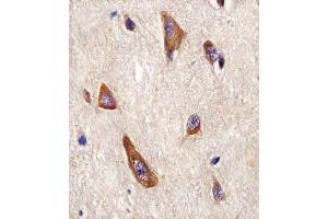 (ABIN6243251 and ABIN6577964) staining LRRK2 in Human brain tissue sections by Immunohistochemistry (IHC-P - paraformaldehyde-fixed, paraffin-embedded sections).