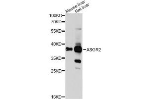 Western blot analysis of extracts of various cell lines, using ASGR2 Antibody (ABIN6290077) at 1:1000 dilution. (Asialoglycoprotein Receptor 2 抗体)