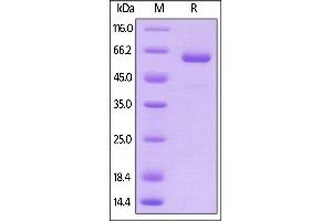 Human Prolactin R, Fc Tag on  under reducing (R) condition.