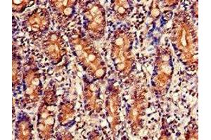 Immunohistochemistry of paraffin-embedded human small intestine tissue using ABIN7142858 at dilution of 1:100 (NUDT1 抗体  (AA 49-82))