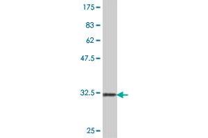 Western Blot detection against Immunogen (32. (eIF4EBP2 抗体  (AA 61-120))