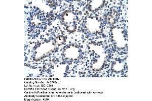 Rabbit Anti-CARS Antibody  Paraffin Embedded Tissue: Human Lung Cellular Data: Alveolar cells Antibody Concentration: 4. (CARS 抗体  (N-Term))