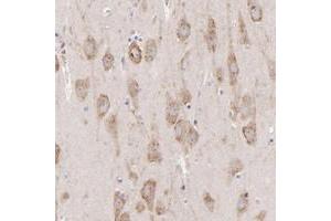 Immunohistochemical staining of human hippocampus with PREX1 polyclonal antibody  shows moderate cytoplasmic positivity in neuronal cells. (PREX1 抗体)