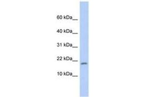 Image no. 1 for anti-Ribosomal Protein S15 (RPS15) (C-Term) antibody (ABIN6744000) (RPS15 抗体  (C-Term))