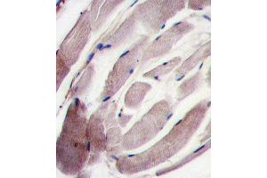 Formalin-fixed and paraffin-embedded human skeletal muscle tissue reacted with the P38 gamma antibody (C-term), which was peroxidase-conjugated to the secondary antibody, followed by DAB staining. (MAPK12 抗体  (C-Term))