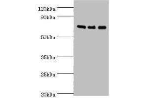 Western blot All lanes: AKAP10 antibody at 7 μg/mL Lane 1: 293T whole cell lysate Lane 2: Hela whole cell lysate Lane 3: HepG2 whole cell lysate Secondary Goat polyclonal to rabbit IgG at 1/10000 dilution Predicted band size: 74 kDa Observed band size: 74 kDa (AKAP1 抗体  (AA 413-662))