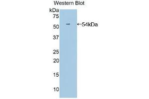 Western blot analysis of the recombinant protein. (ANGPTL3 抗体  (AA 17-460))