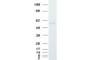 Western Blotting (WB) image for Myocyte Enhancer Factor 2C (MEF2C) (Transcript Variant 1) protein (Myc-DYKDDDDK Tag) (ABIN2725775)