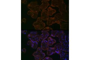 Immunofluorescence analysis of Human placenta using MYO5B antibody (ABIN6129305, ABIN6144287, ABIN6144288 and ABIN6224655) at dilution of 1:100. (MYO5B 抗体  (AA 1440-1690))