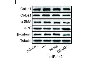 Western Blotting (WB) image for anti-Collagen, Type III, alpha 1 (COL3A1) (AA 1217-1466) antibody (ABIN1679317)