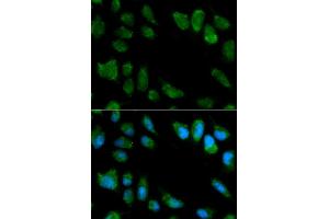 Immunofluorescence analysis of MCF-7 cells using IL1RN antibody. (IL1RN 抗体)