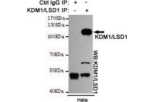 Immunoprecipitation analysis of Hela cell lysates using KDM1/LSD1 mouse mAb. (LSD1 抗体)