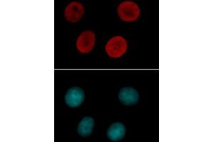 Histone H4 acetyl Lys12 antibody tested by immunofluorescence. (Histone H4 抗体  (acLys12))