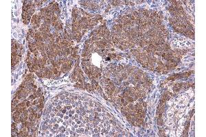 IHC-P Image Cyclin B1 antibody detects Cyclin B1 protein at cytoplasm on mouse ovary by immunohistochemical analysis. (Cyclin B1 抗体)