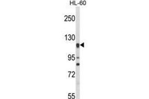 Western blot analysis of NOS3 Antibody (N-term) in HL-60 cell line lysates (35ug/lane). (ENOS 抗体  (N-Term))
