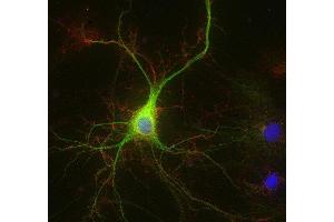 Indirect immunostaining of methanol fixed rat hippocampus neurons with anti-ADAM 22 (dilution 1 : 500; red) and mouse anti-MAP 2 (cat. (ADAM22 抗体)
