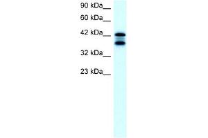 ACAT2 antibody used at 2 ug/ml to detect target protein. (ACAT2 抗体)