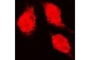 Immunofluorescent analysis of Glutathione Synthetase staining in K562 cells. (Glutathione Synthetase 抗体)
