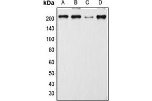 Western blot analysis of CD205 expression in MCF7 (A), SP2/0 (B), H9C2 (C), mouse lymph node (D) whole cell lysates. (LY75/DEC-205 抗体  (Center))
