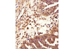 Immunohistochemistry (Paraffin-embedded Sections) (IHC (p)) image for anti-Proteasome (Prosome, Macropain) Subunit, beta Type 2 (PSMB2) (AA 133-163), (C-Term) antibody (ABIN1881696)