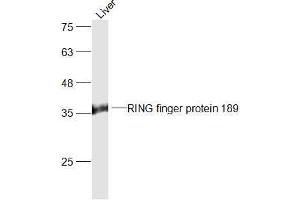 Mouse Liver lysates probed with RING finger protein 189 Polyclonal Antibody, Unconjugated  at 1:300 dilution and 4˚C overnight incubation. (RFFL 抗体  (AA 251-363))