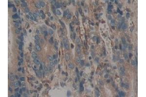 Immunohistochemistry (IHC) image for anti-Calumenin (CALU) (AA 20-315) antibody (ABIN7434203)