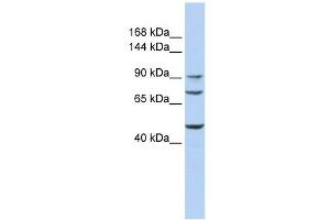 GALNT5 antibody used at 1 ug/ml to detect target protein. (GALNT5 抗体)