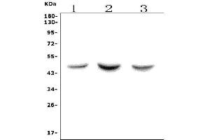 Western blot analysis of ASAH1 using anti-ASAH1 antibody (ABIN7602206). (ASAH1 抗体  (AA 63-393))