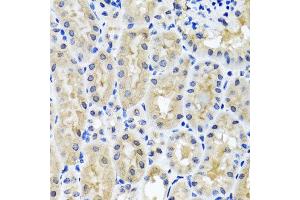 Immunohistochemistry of paraffin-embedded mouse kidney using SNAP29 antibody at dilution of 1:100 (x40 lens). (SNAP29 抗体)