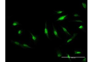 Immunofluorescence of monoclonal antibody to CAND1 on HeLa cell. (CAND1 抗体  (AA 1-100))