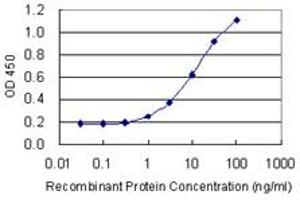 Detection limit for recombinant GST tagged RLF is 0. (RLF 抗体  (AA 1805-1913))