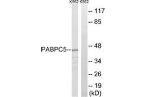 Western blot analysis of extracts from K562 cells, using PABPC5 Antibody. (PABPC5 抗体  (AA 184-233))