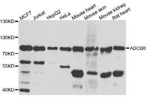 Western blot analysis of extracts of various cell lines, using ABCB8 antibody. (ABCB8 抗体  (AA 469-718))