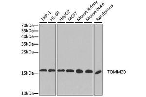 Western blot analysis of extracts of various cell lines, using TOMM20 antibody. (TOMM20 抗体  (AA 20-145))