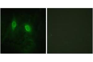 Immunofluorescence analysis of HeLa cells, using IKK-gamma (Ab-85) Antibody. (IKBKG 抗体  (AA 51-100))