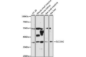 Western blot analysis of extracts of various cell lines, using SLC10 antibody (ABIN6130693, ABIN6147837, ABIN6147838 and ABIN6216622) at 1:3000 dilution. (SLC10A2 抗体  (AA 289-348))