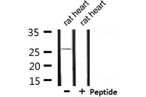 Western blot analysis of extracts from rat heart, using UBTD2 Antibody. (UBTD2 抗体  (C-Term))