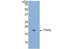 Detection of Recombinant ACVR1, Human using Polyclonal Antibody to Activin A Receptor Type I (ACVR1) (ACVR1 抗体  (AA 208-340))