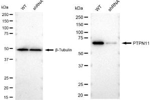 Western blotting analysis using PTPN11 antibody (ABIN7800041).