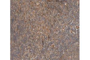 ABIN6267403 at 1/200 staining human lymph node tissue sections by IHC-P. (Phospholipase C gamma 2 抗体  (pTyr753))