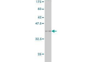 Western Blot detection against Immunogen (36. (MLLT10 抗体  (AA 695-793))