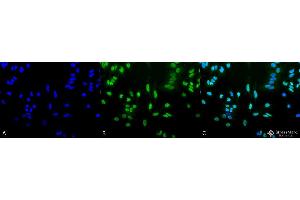 Immunocytochemistry/Immunofluorescence analysis using Rabbit Anti-Acetylated Lysine Polyclonal Antibody . (Lysine (lys) (acetylated) 抗体 (APC))