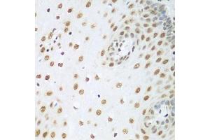 Immunohistochemistry of paraffin-embedded human esophagus using HDAC1 antibody. (HDAC1 抗体  (AA 393-482))