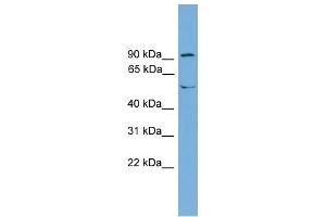 Western Blotting (WB) image for anti-Nuclear Receptor Subfamily 4, Group A, Member 3 (NR4A3) (Middle Region) antibody (ABIN2784460)